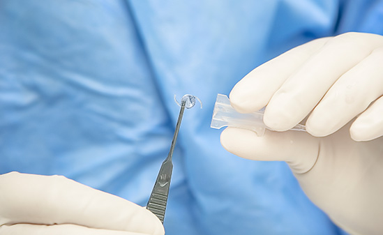 An image of a surgeon removing an intraocular lens from some packaging using a pair of tweezers.