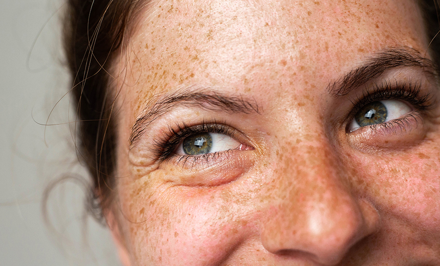 Close up image of a smiling women's face (nose, eyes and forehead). The woman has curly auburn hair (tied back), hazel eyes and freckles. You can tell she is smiling by the crinkling of her eyes and nose.