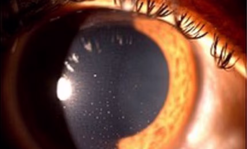 An open eye framed by eyelashes. The iris is coloured brown, with a black pupil centrally positioned.