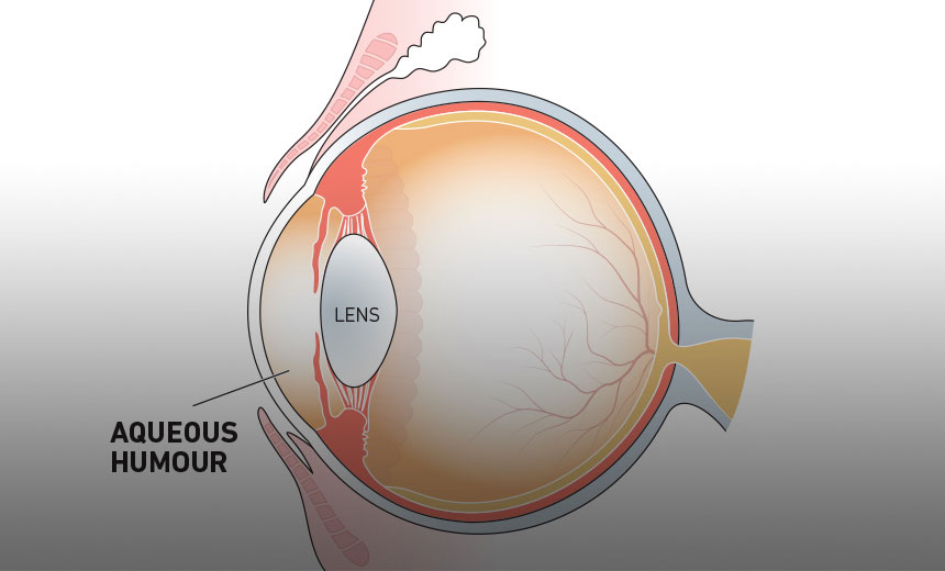 vitreous-body-vs-aqueous-humor