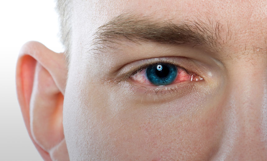 eye bacterial infection