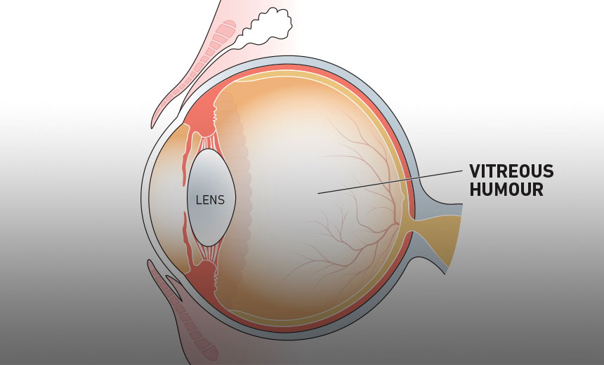 What Is Vitreous Humor